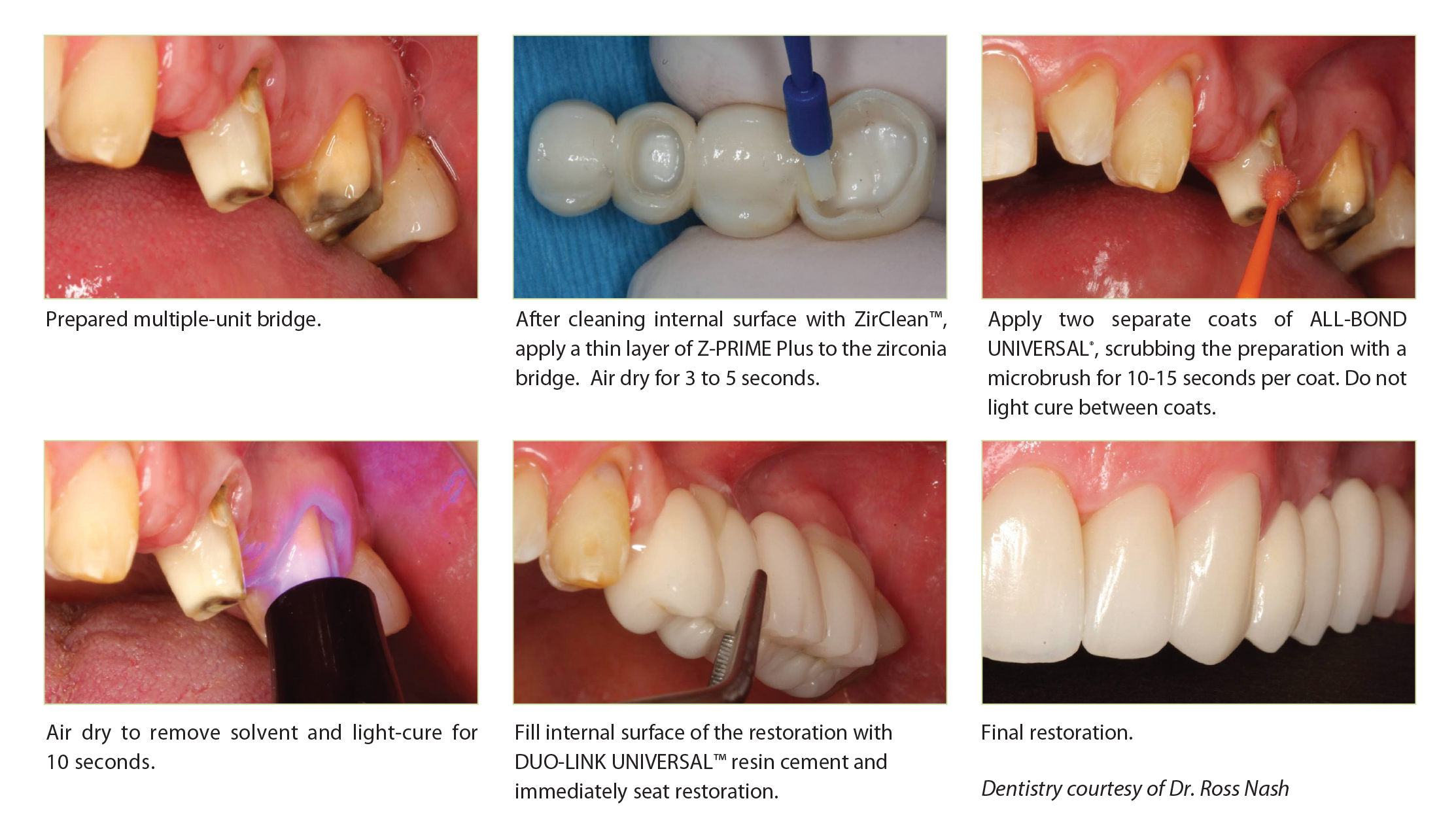 ZPP Procedure ZPP Procedure